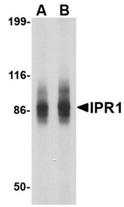 SP110 Antibody - BSA Free, Novus Biologicals:Antibodies:Primary Antibodies