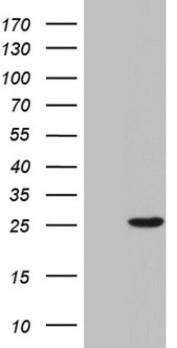 SP17 Antibody (OTI2G6), Novus Biologicals 0.1mL; Unlabeled:Antibodies,