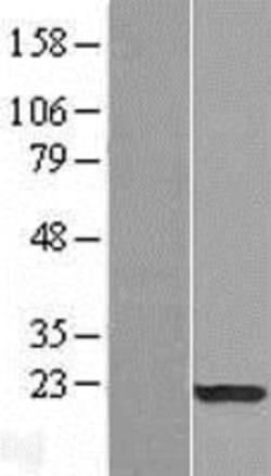 Novus Biologicals™ SP17 Overexpression Lysate
