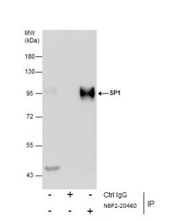 SP1 Antibody, Novus Biologicals 0.1mL; Unlabeled:Antibodies, Polyclonal