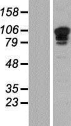 Novus Biologicals&trade;&nbsp;Sp3 Overexpression Lysate