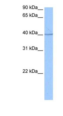 SP6 Antibody, Novus Biologicals 100 &mu;L | Buy Online | Novus Biologicals | Fisher Scientific