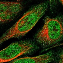 SPACA3 Antibody, Novus Biologicals:Antibodies:Primary Antibodies