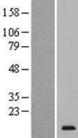 Novus Biologicals™ SPACA4 Overexpression Lysate