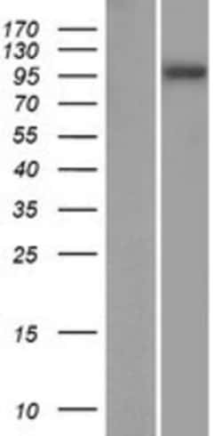 Novus Biologicals™ SPAG1 Overexpression Lysate