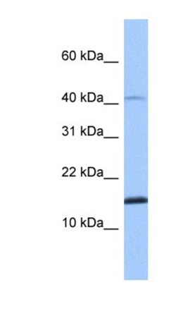 SPAG11B Antibody, Novus Biologicals 0.05mg; Unlabeled:Antibodies, Polyclonal