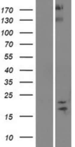 Novus Biologicals&trade;&nbsp;SPAG11B Overexpression Lysate