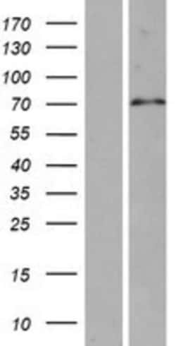 Novus Biologicals™ SPAG16 Overexpression Lysate