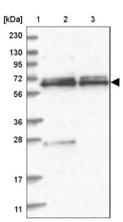 SPAG16 Antibody, Novus Biologicals 0.1mL; Unlabeled:Antibodies, Polyclonal