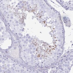 SPAG4 Antibody, Novus Biologicals:Antibodies:Primary Antibodies