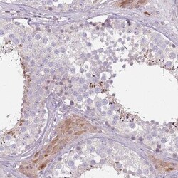 SPAG4 Antibody, Novus Biologicals:Antibodies:Primary Antibodies