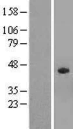 Novus Biologicals&trade;&nbsp;SPAG4L Overexpression Lysate