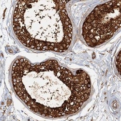 SPAG9 Antibody, Novus Biologicals 25 &mu;L; Unlabeled:Antibodies, Polyclonal