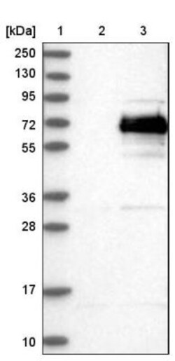 SPAM1 Antibody, Novus Biologicals:Antibodies:Primary Antibodies