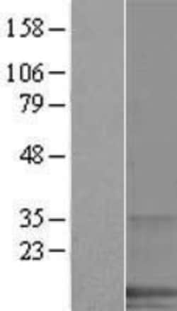 Novus Biologicals&trade;&nbsp;SPANXA1 Overexpression Lysate