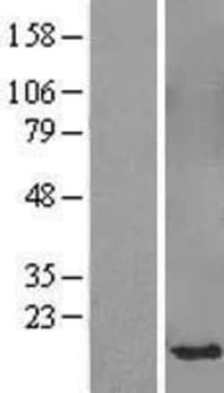 Novus Biologicals™ SPANXB1 Overexpression Lysate