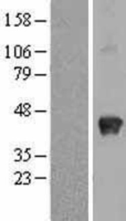 Novus Biologicals™ SPARC Overexpression Lysate