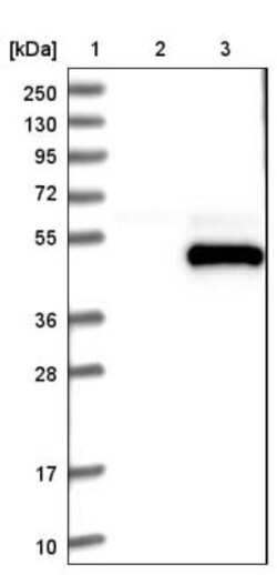 SPARC Antibody, Novus Biologicals:Antibodies:Primary Antibodies