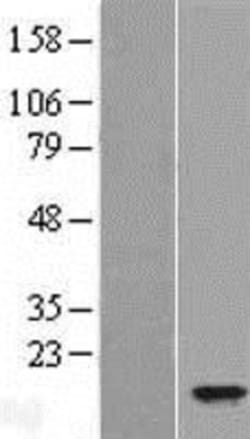 Novus Biologicals™ TFF2 Overexpression Lysate
