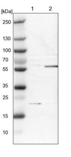 Spastin Antibody, Novus Biologicals 25 &mu;L | Buy Online | Novus Biologicals | Fisher Scientific
