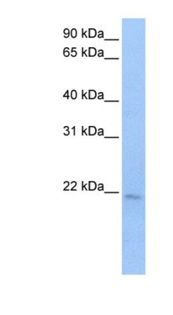 SPATA12 Antibody, Novus Biologicals 100&mu;L; Unlabeled:Antibodies, Polyclonal
