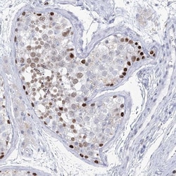 SPATA16 Antibody, Novus Biologicals:Antibodies:Primary Antibodies