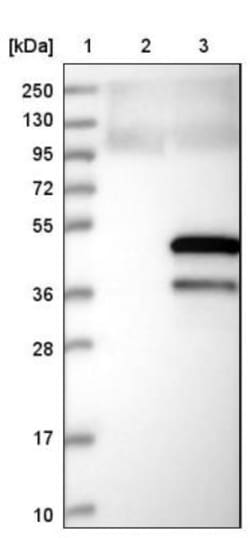 SPATA17 Antibody, Novus Biologicals 0.1mL; Unlabeled:Antibodies, Polyclonal