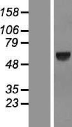 Novus Biologicals&trade;&nbsp;SPATA18 Overexpression Lysate