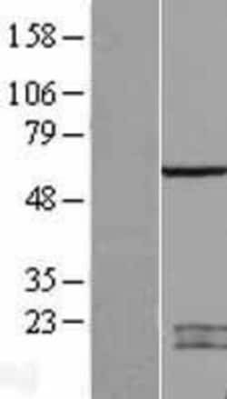 Novus Biologicals&trade;&nbsp;SPATA2 Overexpression Lysate