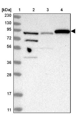 SPATA20 Antibody, Novus Biologicals 25 &mu;L | Buy Online | Novus Biologicals | Fisher Scientific