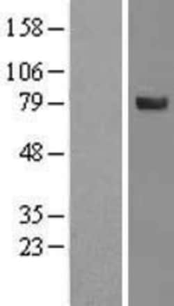 Novus Biologicals&trade;&nbsp;SPATA20 Overexpression Lysate