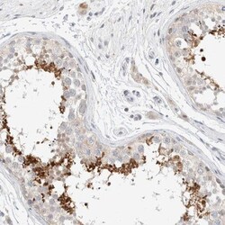 SPATA20 Antibody, Novus Biologicals 25 &mu;L | Buy Online | Novus Biologicals | Fisher Scientific