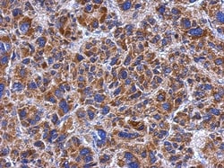 SPATA4 Antibody, Novus Biologicals 0.1 mL | Buy Online | Novus Biologicals | Fisher Scientific