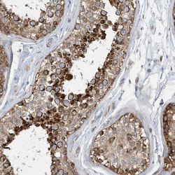 SPATA5 Antibody, Novus Biologicals:Anticuerpos:Anticuerpos primarios