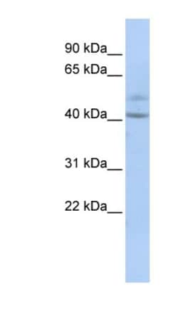 SPATC1 Antibody, Novus Biologicals 100&mu;L; Unlabeled:Antibodies, Polyclonal