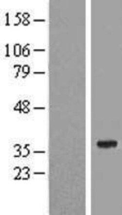Novus Biologicals™ SPATS1 Overexpression Lysate