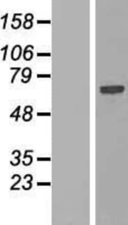 Novus Biologicals&trade;&nbsp;SPATS2L Overexpression Lysate