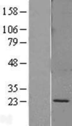 Novus Biologicals&trade;&nbsp;SPC18 Overexpression Lysate