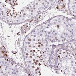SPC24 Antibody, Novus Biologicals 25 &mu;L | Buy Online | Novus Biologicals | Fisher Scientific
