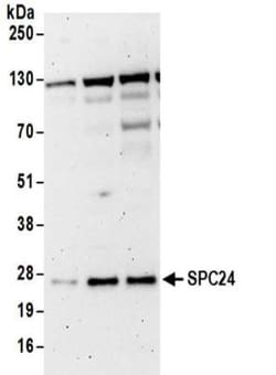 SPC24 Antibody, Novus Biologicals 0.1mg; Unlabeled:Antibodies, Polyclonal