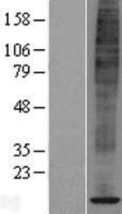 Novus Biologicals™ SPCS1 Overexpression Lysate
