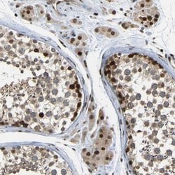 SPCS2 Antibody, Novus Biologicals:Antibodies:Primary Antibodies