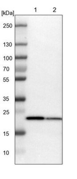 SPCS2 Antibody, Novus Biologicals:Antibodies:Primary Antibodies