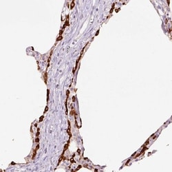 SP-D Antibody, Novus Biologicals 0.1mL; Unlabeled:Antibodies, Polyclonal