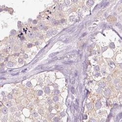 SP-D Antibody, Novus Biologicals 0.1mL; Unlabeled:Antibodies, Polyclonal