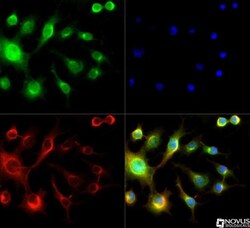 Spectrin beta 3 Antibody, Novus Biologicals:Antibodies:Primary Antibodies