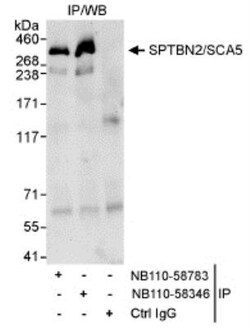 Spectrin beta 3 Antibody, Novus Biologicals:Antibodies:Primary Antibodies
