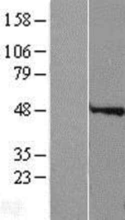 Novus Biologicals™ Speedy/Ringo Overexpression Lysate