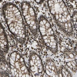 SPEN Antibody, Novus Biologicals 0.10mL | Buy Online | Novus Biologicals | Fisher Scientific