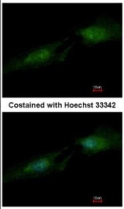 Spermine synthase Antibody, Novus Biologicals 0.1mL; Unlabeled:Antibodies,
